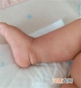 宝宝皮肤白不白和什么有关
