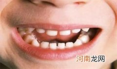 婴幼儿牙缝很大怎么办