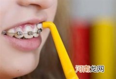 戴完牙套饭后必须刷牙吗